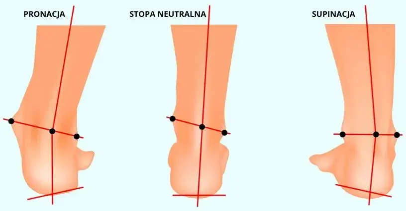 rodzaje st&oacute;p pronacja supinacja neutralna